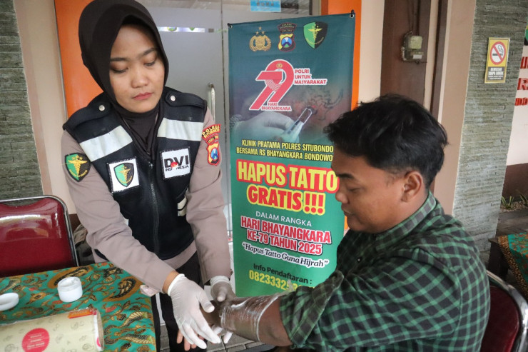 Polres Situbondo Beri Layanan Hapus Tato Gratis di Hari Bhayangkara ke -79